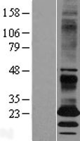 EBPL Human Over-expression Lysate