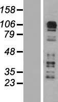 CARD6 Human Over-expression Lysate