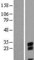 SMRP1 (C9orf24) Human Over-expression Lysate