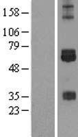 CREB3L3 Human Over-expression Lysate