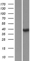 SSBP4 Human Over-expression Lysate