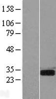 SPSB2 Human Over-expression Lysate