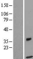 SPRYD5 (TRIM51) Human Over-expression Lysate