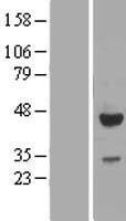 EFCAB4B (CRACR2A) Human Over-expression Lysate