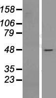 NFATC2IP Human Over-expression Lysate