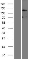 FBH1 Human Over-expression Lysate
