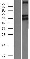 LRP11 Human Over-expression Lysate