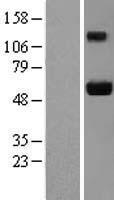 AJUBA Human Over-expression Lysate