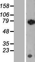 RECQ1 (RECQL) Human Over-expression Lysate
