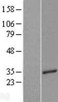TCEAL3 Human Over-expression Lysate