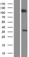 PCDH10 Human Over-expression Lysate
