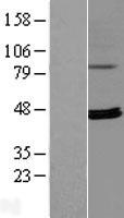 RPUSD4 Human Over-expression Lysate