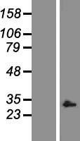 Caspase 9 (CASP9) Human Over-expression Lysate
