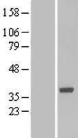 BOULE (BOLL) Human Over-expression Lysate