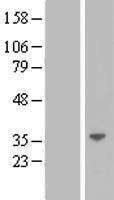 LGALS12 Human Over-expression Lysate
