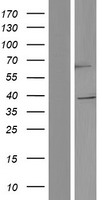 TRIM5 alpha (TRIM5) Human Over-expression Lysate