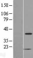 PSKH2 Human Over-expression Lysate