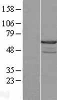 CABS1 Human Over-expression Lysate