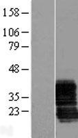 ZCRB1 Human Over-expression Lysate