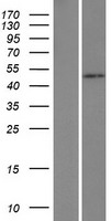 HSFY1 Human Over-expression Lysate