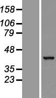 GTPBP10 Human Over-expression Lysate
