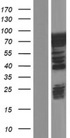 Caldesmon (CALD1) Human Over-expression Lysate