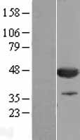 CNPase (CNP) Human Over-expression Lysate