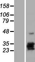 hCG beta (CGB8) Human Over-expression Lysate