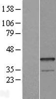 Epithelial Stromal Interaction 1 (EPSTI1) Human Over-expression Lysate