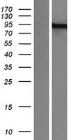 PML Protein (PML) Human Over-expression Lysate