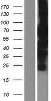 PML Protein (PML) Human Over-expression Lysate