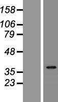 IDI2 Human Over-expression Lysate