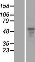 FOXQ1 Human Over-expression Lysate