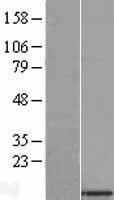 C22orf32 (SMDT1) Human Over-expression Lysate