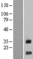 MRPS12 Human Over-expression Lysate