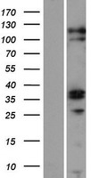 ZC3H12C Human Over-expression Lysate