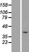 MCART1 (SLC25A51) Human Over-expression Lysate