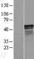 CIPC Human Over-expression Lysate