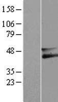 Membralin (TMEM259) Human Over-expression Lysate