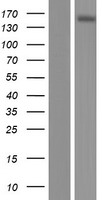 ABCC10 Human Over-expression Lysate