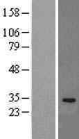IL33 Human Over-expression Lysate