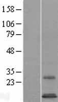SYS1 Human Over-expression Lysate