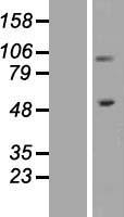 Integrin beta 1 (ITGB1) Human Over-expression Lysate