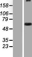 DYNC2I2 Human Over-expression Lysate