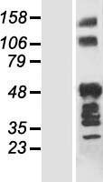 ANKRD40 Human Over-expression Lysate