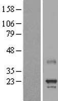 MED8 Human Over-expression Lysate