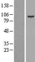 SMYD4 Human Over-expression Lysate