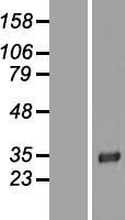 LRP15 (LRRC3B) Human Over-expression Lysate