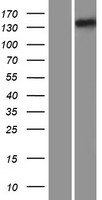 IFT122 Human Over-expression Lysate