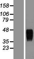 TEM8 (ANTXR1) Human Over-expression Lysate